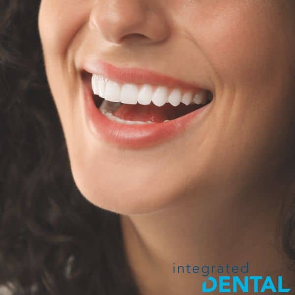 dental veneers
