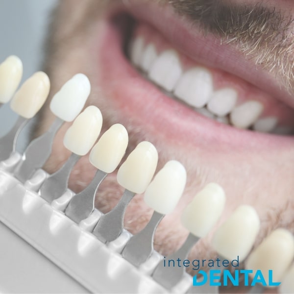 veneers in woodbury NY