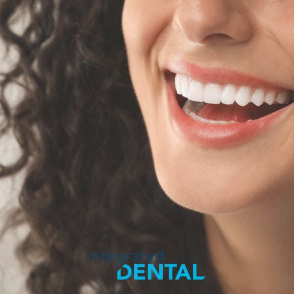 all-on-4 dental implants carle place integrateddental