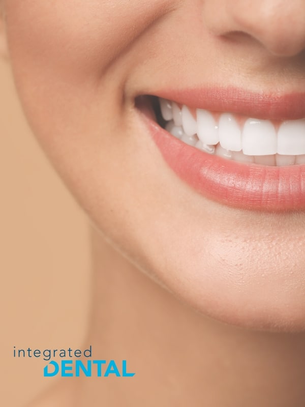 all-on-4 dental implants in locust valley integrateddental
