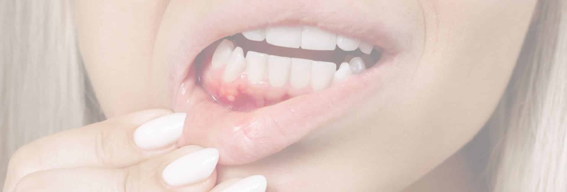 integrateddental gum treatment in woodbury 2 (1)